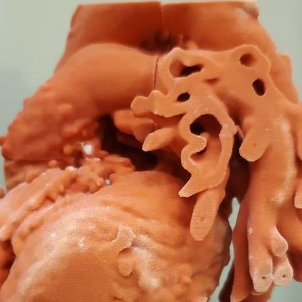 3d printed human heart